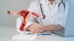 Lekarz wypełnia kwestionariusz wizyty, przed nim położony jest model żeńskiego układu rozrodczego. /Źródło: 123rf.com