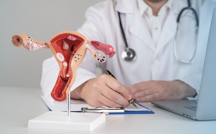 Lekarz wypełnia kwestionariusz wizyty, przed nim położony jest model żeńskiego układu rozrodczego. /Źródło: 123rf.com