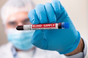 Pielęgniarz ubrany w sterylny strój trzyma w dłoni fiolkę wypełnioną pobraną wcześniej krwią pacjenta w celu analizy i diagnostyki laboratoryjnej. Źródło: 123rf.com