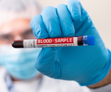 Pielęgniarz ubrany w sterylny strój trzyma w dłoni fiolkę wypełnioną pobraną wcześniej krwią pacjenta w celu analizy i diagnostyki laboratoryjnej. Źródło: 123rf.com