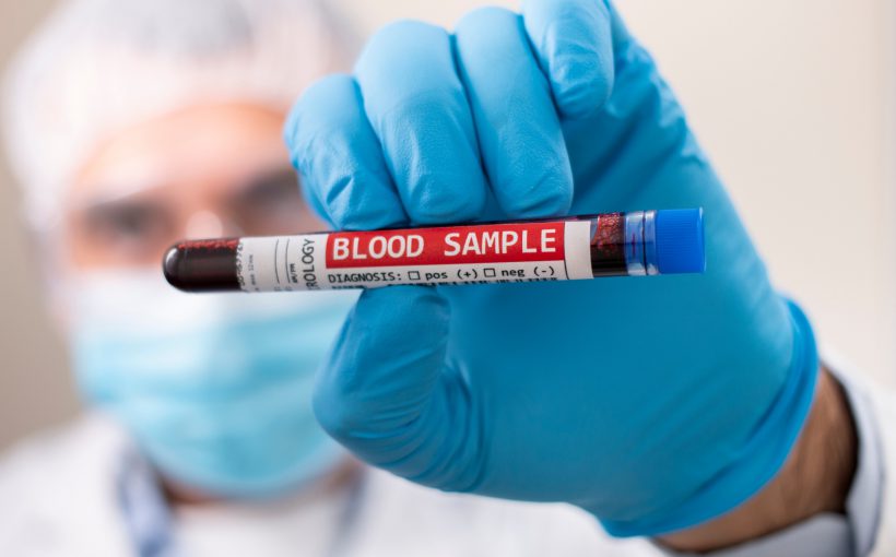 Pielęgniarz ubrany w sterylny strój trzyma w dłoni fiolkę wypełnioną pobraną wcześniej krwią pacjenta w celu analizy i diagnostyki laboratoryjnej. Źródło: 123rf.com