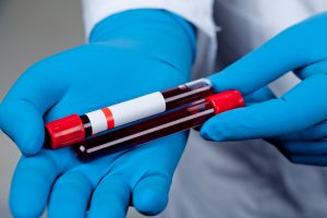 Asystent medyczny trzyma w dłoniach odzianych w niebieskie, sterylne rękawiczki, dwie fiolki z pobraną krwią pacjentów do diagnostyki laboratoryjnej. Źródło: 123rf.com