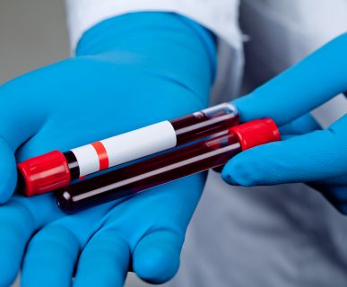 Asystent medyczny trzyma w dłoniach odzianych w niebieskie, sterylne rękawiczki, dwie fiolki z pobraną krwią pacjentów do diagnostyki laboratoryjnej. Źródło: 123rf.com