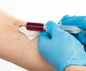Pielęgniarka pobiera krew z żyły u ręki pacjenta w celu diagnostyki laboratoryjnej. /Źródło 123rf.com