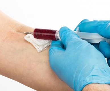 Pielęgniarka pobiera krew z żyły u ręki pacjenta w celu diagnostyki laboratoryjnej. /Źródło 123rf.com