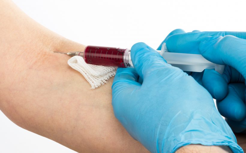 Pielęgniarka pobiera krew z żyły u ręki pacjenta w celu diagnostyki laboratoryjnej. /Źródło 123rf.com
