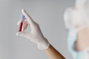 Pielegniarz trzyma w dłoniach odzianych w sterylne rękawiczki fiolkę z próbką krwi pobraną do celów diagnostycznych. /Źródło 123rf.com