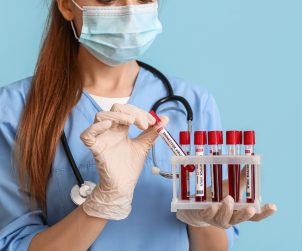 Pielęgniarka odziana w medyczny strój trzyma w dłoniach probówki wypełnione krwią pacjentów do celów dalszej diagnostyki laboratoryjnej. Źródło: 123rf.com