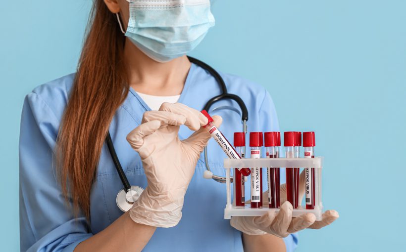 Pielęgniarka odziana w medyczny strój trzyma w dłoniach probówki wypełnione krwią pacjentów do celów dalszej diagnostyki laboratoryjnej. Źródło: 123rf.com
