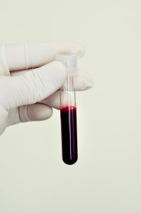 Słoń odziana w białą, sterylną rękawiczkę trzyma fiolkę z próbką krwi do celów diagnostycznych. Źródło: 123rf.com