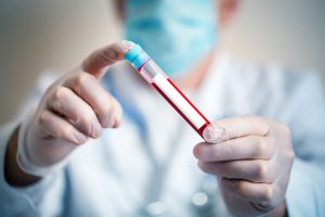 Pielęgniarz w sterylnym fartuchu trzyma w dłoniach odzianych w rękawiczki fiolkę z próbką krwi pacjenta do celu dalszej diagnostyki oraz leczenia. Źródło: 123rf.com