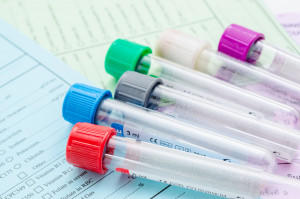 Badania laboratoryjne Ostrołęka badania krwi