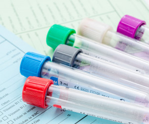 Badania laboratoryjne Ostrołęka badania krwi