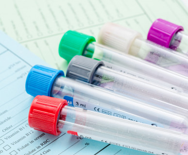 Badania laboratoryjne Ostrołęka badania krwi