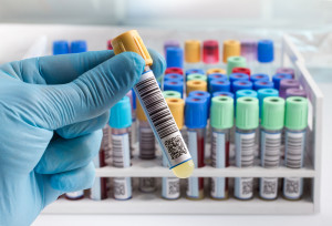 Badania laboratoryjne w Żorach