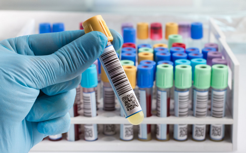 Badania laboratoryjne w Żorach