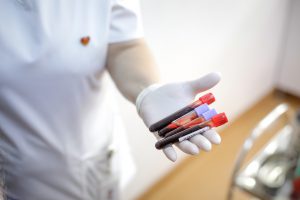 Pielęgniarka w sterylnych białych rękawiczkach trzyma w dłoni cztery fiolki z krwią pacjenta w celu diagnostyki laboratoryjnej. Źródło 123rf.com
