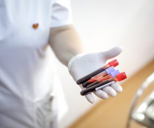 Pielęgniarka w sterylnych białych rękawiczkach trzyma w dłoni cztery fiolki z krwią pacjenta w celu diagnostyki laboratoryjnej. Źródło 123rf.com