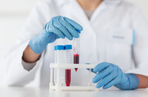 Badanie krwi Piotrków Trybunalski laboratorium