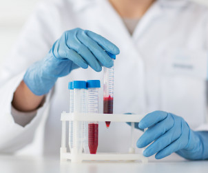 Badanie krwi Piotrków Trybunalski laboratorium