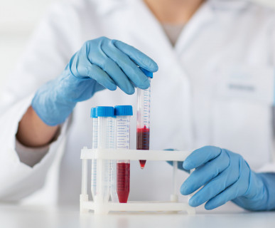 Badanie krwi Piotrków Trybunalski laboratorium