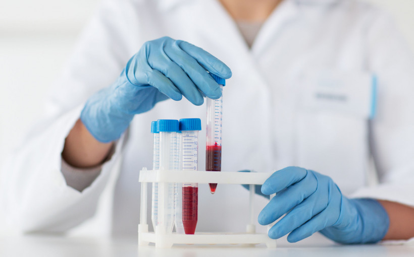 Badanie krwi Piotrków Trybunalski laboratorium