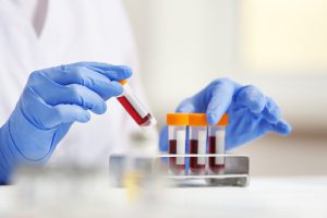 Pracownik medyczny układa fiolki z próbkami krwi pobranej wcześniej pacjentowi.