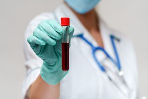 Lekarz ubrany w fartuch ze stetoskopem na szyi trzyma w dłoniach fiolkę z wcześniej pobraną krwią pacjenta.
