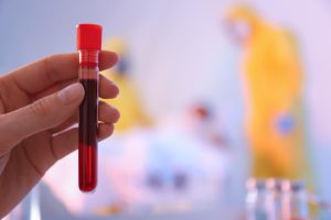 Fiolka krwi, która została pobrana pacjentowi do diagnostyki i dalszego leczenia.