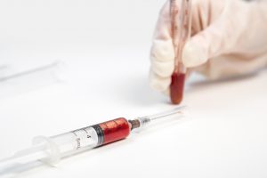 Pielęgniarka trzyma w dłoni fiolkę z próbką krwi pobraną wcześniej pacjentowi, obok leży strzykawka z krwią. Źródło: 123rf.com