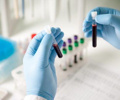 Pracownik medyczny w sterylnych rękawiczkach trzyma dwie fiolki z pobraną próbką krwi. Źródło: 123rf.com