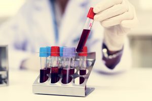Pielęgniarka po pobraniu krwi pacjentowi układa probówki w organizerze w celu analizy i diagnostyki.