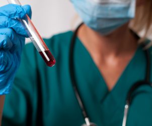 Lekarz ze stetoskopem na szyi trzyma w dłoni odzianej w rękawiczkę fiolkę z próbką krwi pacjenta. Źródło: 123rf.com