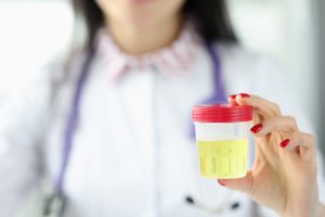 Lekarka w białym fartuchu ze stetoskopem na szyi trzyma w dłoni pojemnik z próbką moczu pacjenta w celu przekazania go do diagnostyki laboratoryjnej. Źródło: 123rf.com