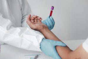 Lekarz uciska miejsce pobrania krwi pacjentowi, a w drugiej dłoni trzyma fiolkę z próbką krwi. 