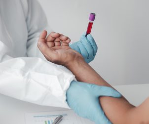 Lekarz uciska miejsce pobrania krwi pacjentowi, a w drugiej dłoni trzyma fiolkę z próbką krwi. Źródło: 123rf.com