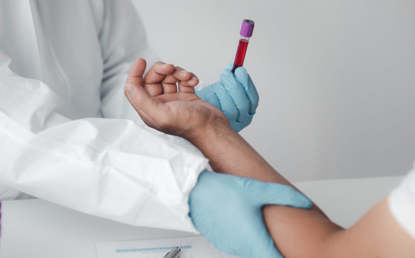 Lekarz uciska miejsce pobrania krwi pacjentowi, a w drugiej dłoni trzyma fiolkę z próbką krwi. Źródło: 123rf.com