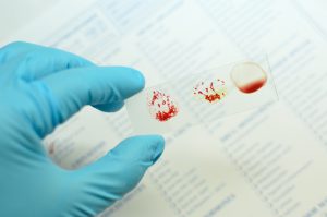 Asystent medyczny trzyma w dłoni szklaną płytkę, na której jest kilka kropel krwi do analizy.