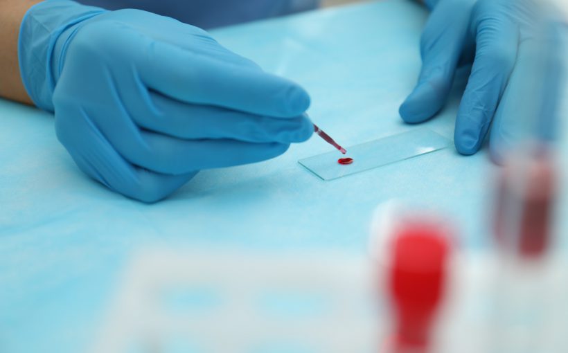 Lekarz rozpoczyna analizę próbki krwi pacjenta. Źródło: 123rf.com