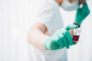 Pielęgniarka ubrana w sterylny strój trzyma w dłoni pobraną próbkę krwi pacjenta do celów diagnostyki i analizy laboratoryjnej. Źródło: 123rf.com