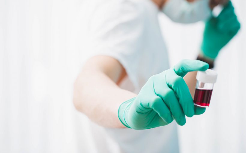 Pielęgniarka ubrana w sterylny strój trzyma w dłoni pobraną próbkę krwi pacjenta do celów diagnostyki i analizy laboratoryjnej. Źródło: 123rf.com