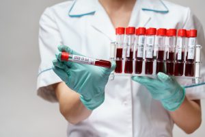 Pielęgniarka ubrana w sterylne rękawiczki i ubranie medyczne, trzyma w dłoniach fiolki z pobranymi próbkami krwi pacjentów.
