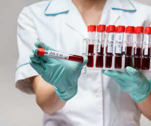 Pielęgniarka ubrana w sterylne rękawiczki i ubranie medyczne, trzyma w dłoniach fiolki z pobranymi próbkami krwi pacjentów. Źródło: 123rf.com