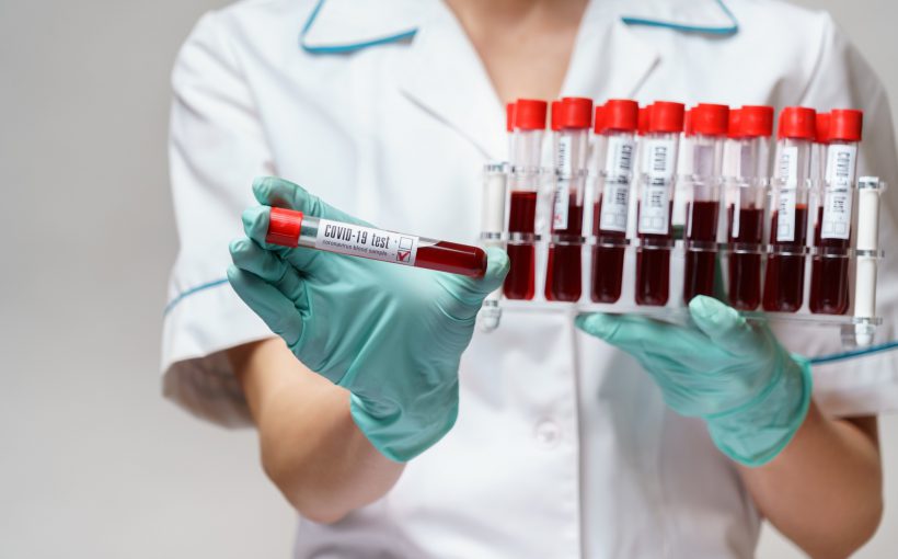 Pielęgniarka ubrana w sterylne rękawiczki i ubranie medyczne, trzyma w dłoniach fiolki z pobranymi próbkami krwi pacjentów. Źródło: 123rf.com