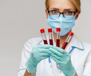 Pielęgniarka trzyma w dłoniach cztery fiolki z krwią pobraną do analizy laboratoryjnej w celu diagnostyki. Źródło: 123rf.com