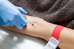 Pielęgniarka pobiera pacjentowi krew z żyły w celu diagnostyki.