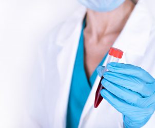 Lekarka w białym fartuchu trzyma w dłoni fiolkę z pobraną krwią pacjenta do analizy i dalszej diagnostyki. Źródło: 123rf.com