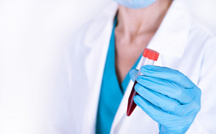 Lekarka w białym fartuchu trzyma w dłoni fiolkę z pobraną krwią pacjenta do analizy i dalszej diagnostyki. Źródło: 123rf.com