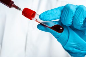 Lekarz w niebieskich rękawiczkach trzyma w rękach probówkę z krwią.