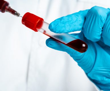 Lekarz w niebieskich rękawiczkach trzyma w rękach probówkę z krwią. Źródło: 123rf.com
